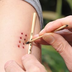 Kambô application points (gates) on the skin